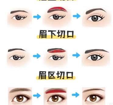 提眉