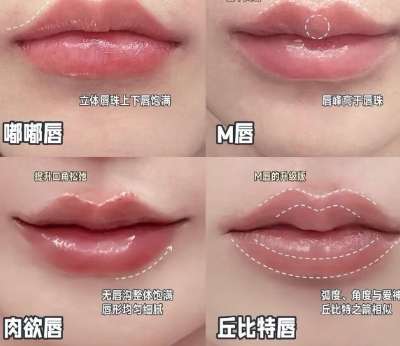 丰唇