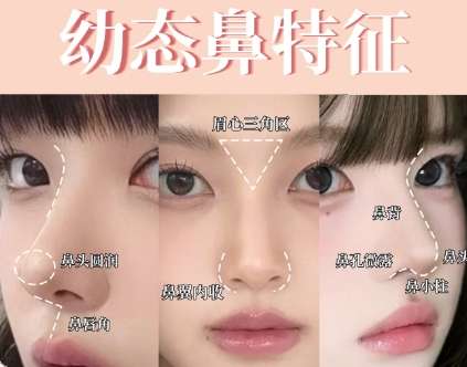 隆鼻