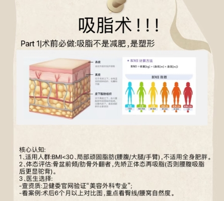 吸脂